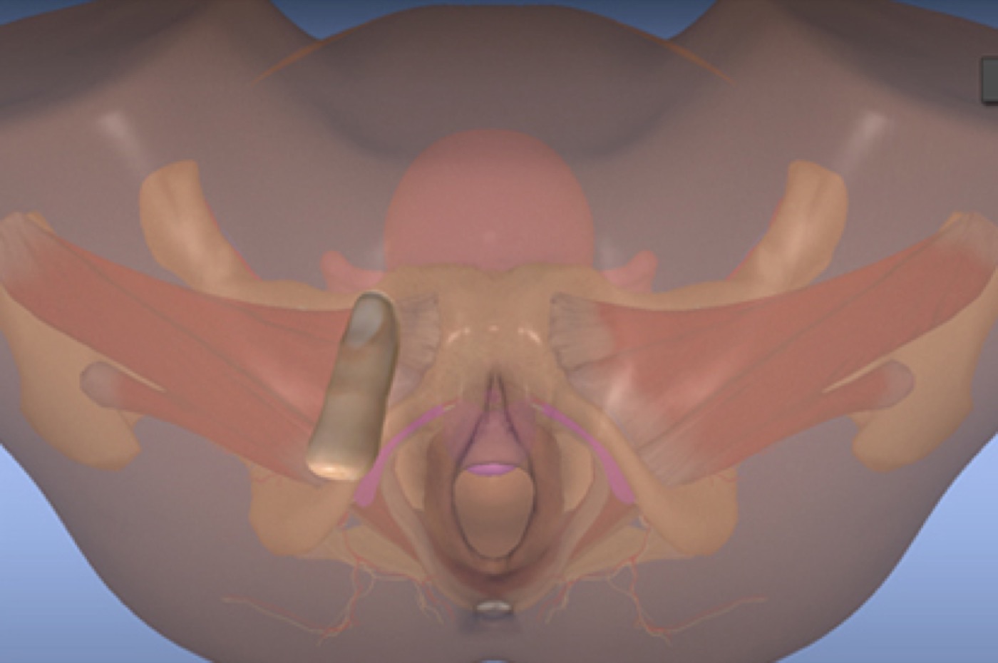 PELVIC Mentor — фото 3